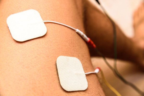 Elektrotherapie Elektrotherapie